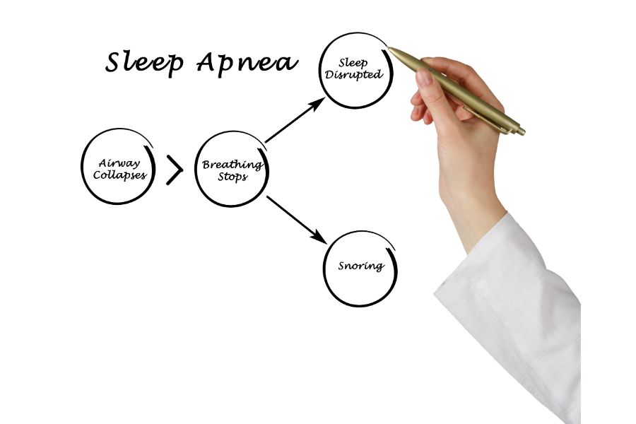 Sleep Apnea